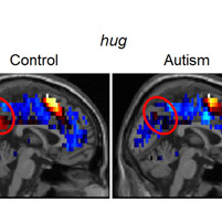 Brain Representations of Social Thoughts Accurately Predict Autism Diagnosis