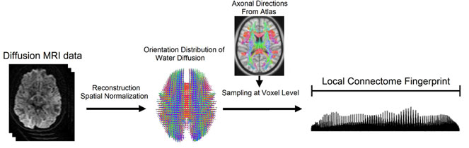 The image above illustrates Local Connectome Fingerprinting. The local connectome is the point-by-point connections along all of the white matter pathways in the brain, as opposed to the connections between brain regions. To create a fingerprint, the research team took the data from the diffusion MRI and reconstructed it to calculate the distribution of water diffusion along the cerebral white matter's fibers.