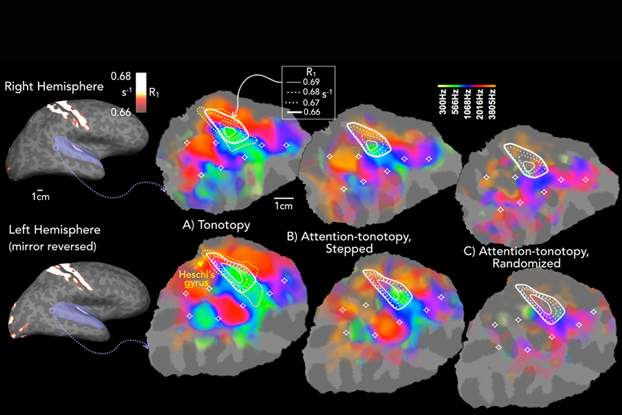 Image of auditory cortical maps of sound frequency and attention.