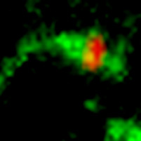 Stopping Shiga Toxin