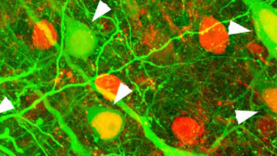 Carnegie Mellon Joins IARPA Project To Reverse-Engineer Brain Algorithms