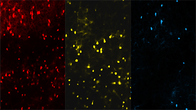 Three types of neurons found in the cerebral cortex.