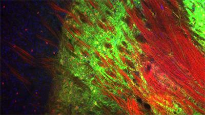 Fluorescent image of the external globus pallidus.