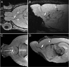 MRI imaging can be used to follow the migration of neuroblasts tagged with a ferritin-based reporter. Tagged cells are pointed out by the white arrows.