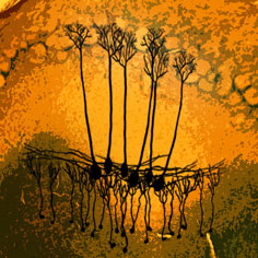 Computer enhanced image of mitral cells and olfactory bulb tissue. Credit: Sonya Giridhar