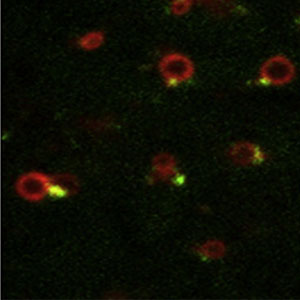 Endosomes in live cells with b2AR tubules emanating from the specialized domains marked by actin.