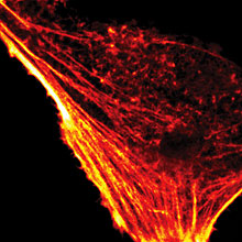 Fluorescence confocal microscope image