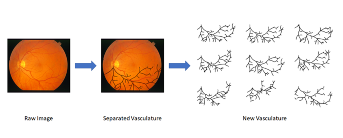 Vascular Network Classification in Retinal Fundus Images