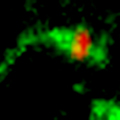 Shiga Toxin