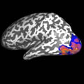 Neuron