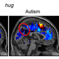 brain image