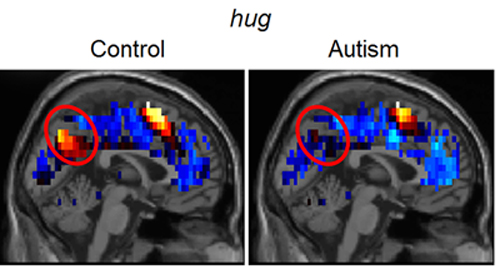 hug brain images