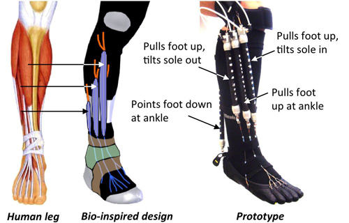 Orthotic Robot Design