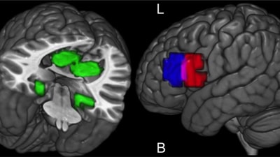 Brain Regions