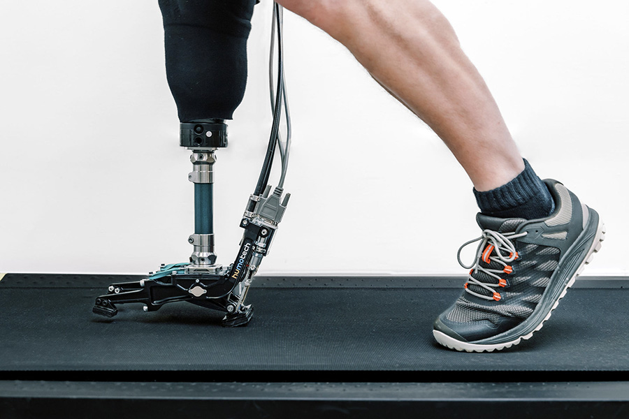 Close-up of a person walking on a treadmill with a robotic prosthetic leg.