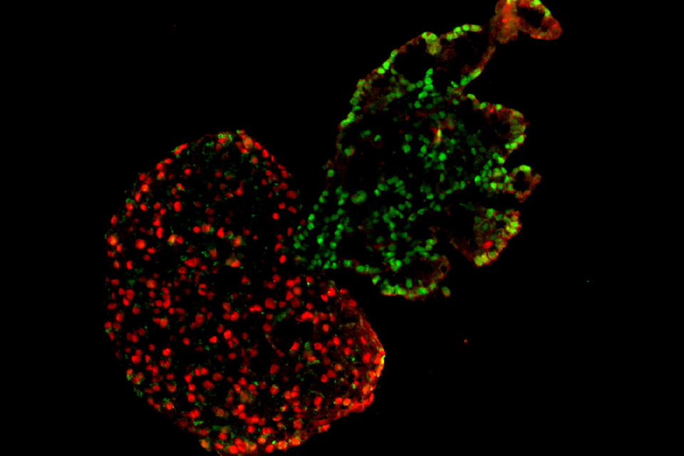 Profs. Adam Feinberg and Charlie Ren, along with colleagues from Boston University, introduce the first lab model for human heart and lung co-development. 