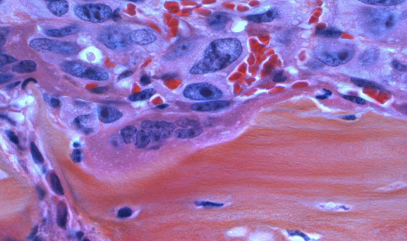 Revolutionizing early cancer detection with at-home technology