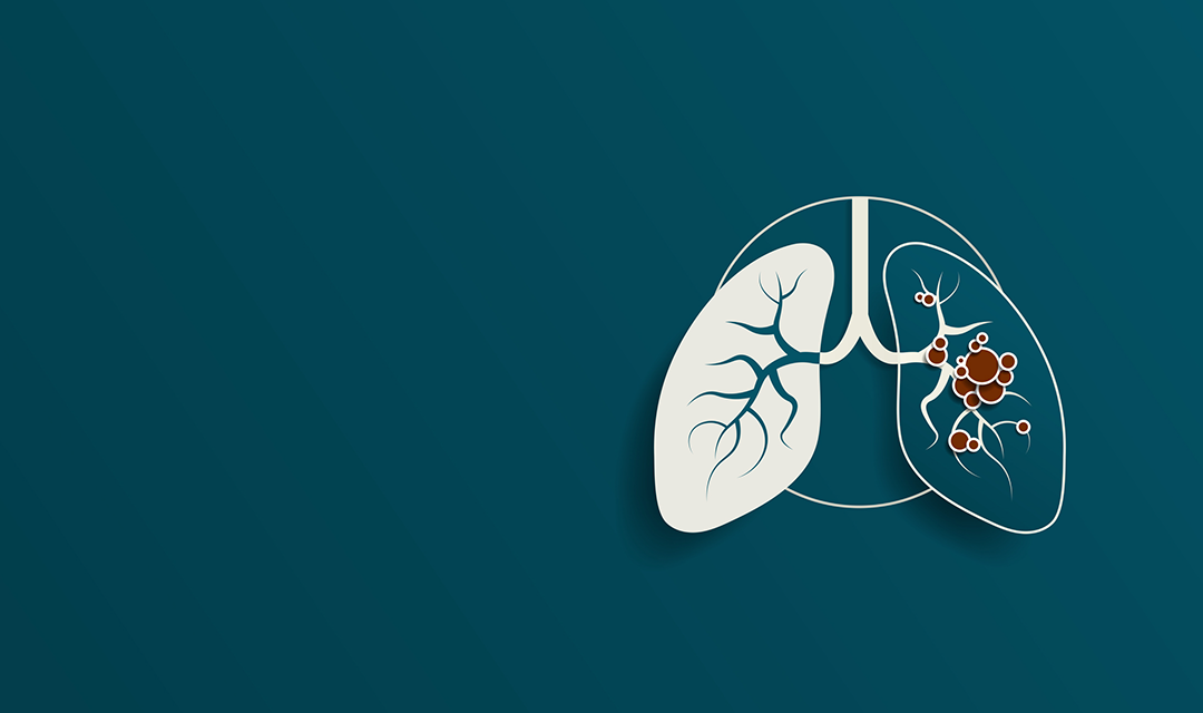 Uncovering how cells reshape their surroundings