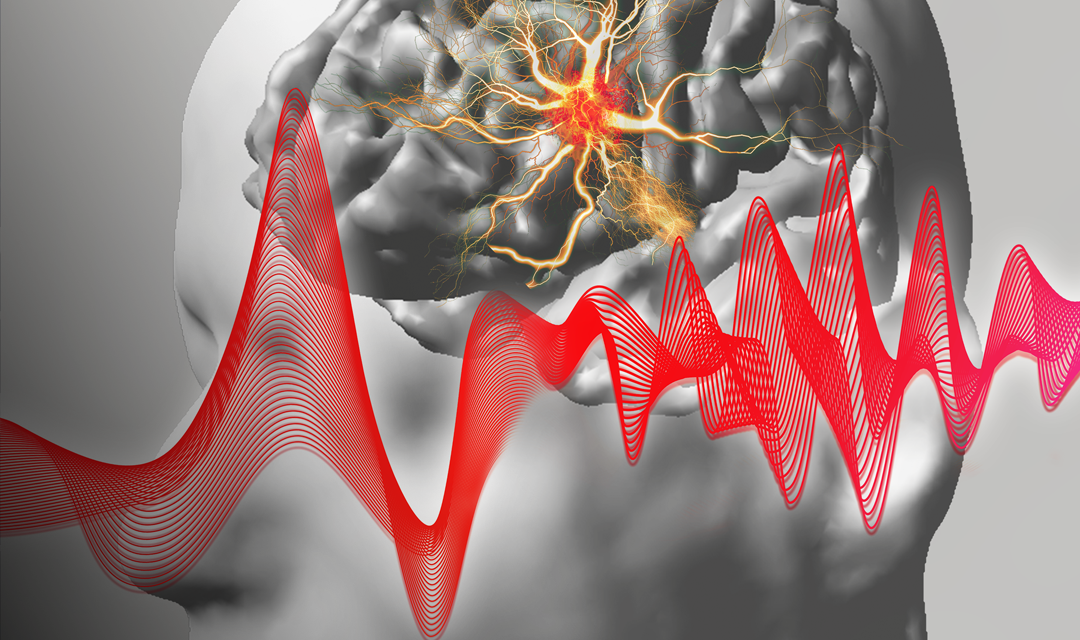 noninvasive technologies for epilepsy patients