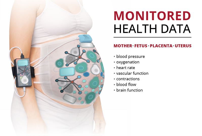 fetal monitor
