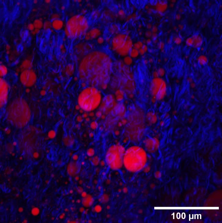 Adipose fibrosis