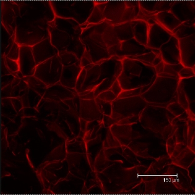 Silk scaffolds can be used for many different tissue types