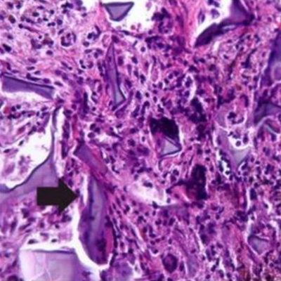 Hematoxylin and eosin stain