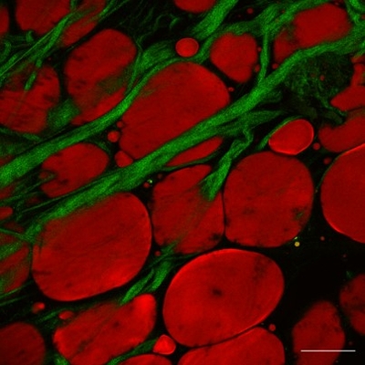 Image of adipose tissue