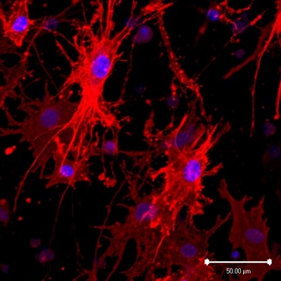 Phalloidin staining