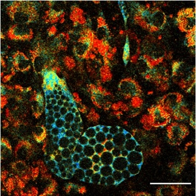 Non-invasive assessments of adipocytes