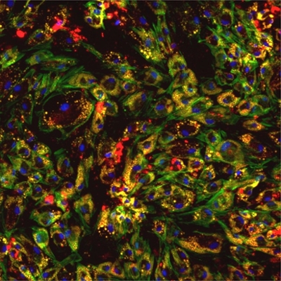 Image of adipocytes differentiated in BPA