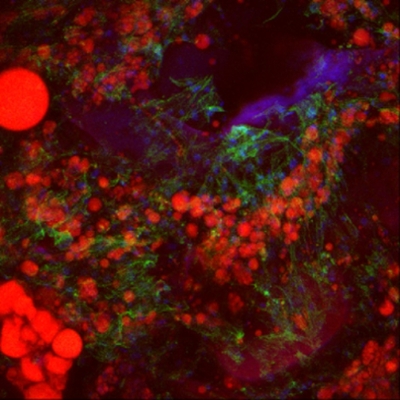 Image of adipose tissue in a silk scaffold.