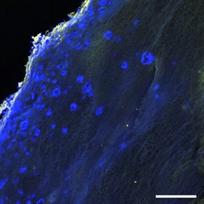 Histology of three dimensional skin constructs