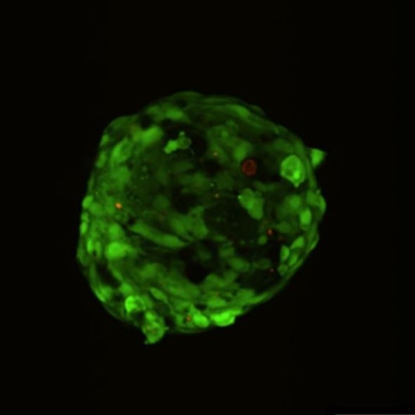 Steatotic organoid