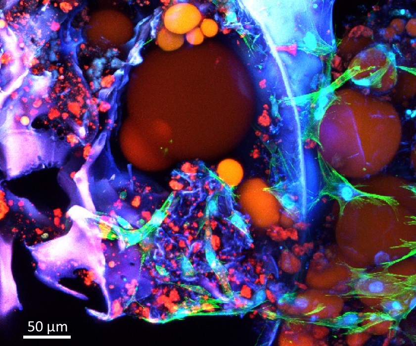 Adipose tissue engineered construct