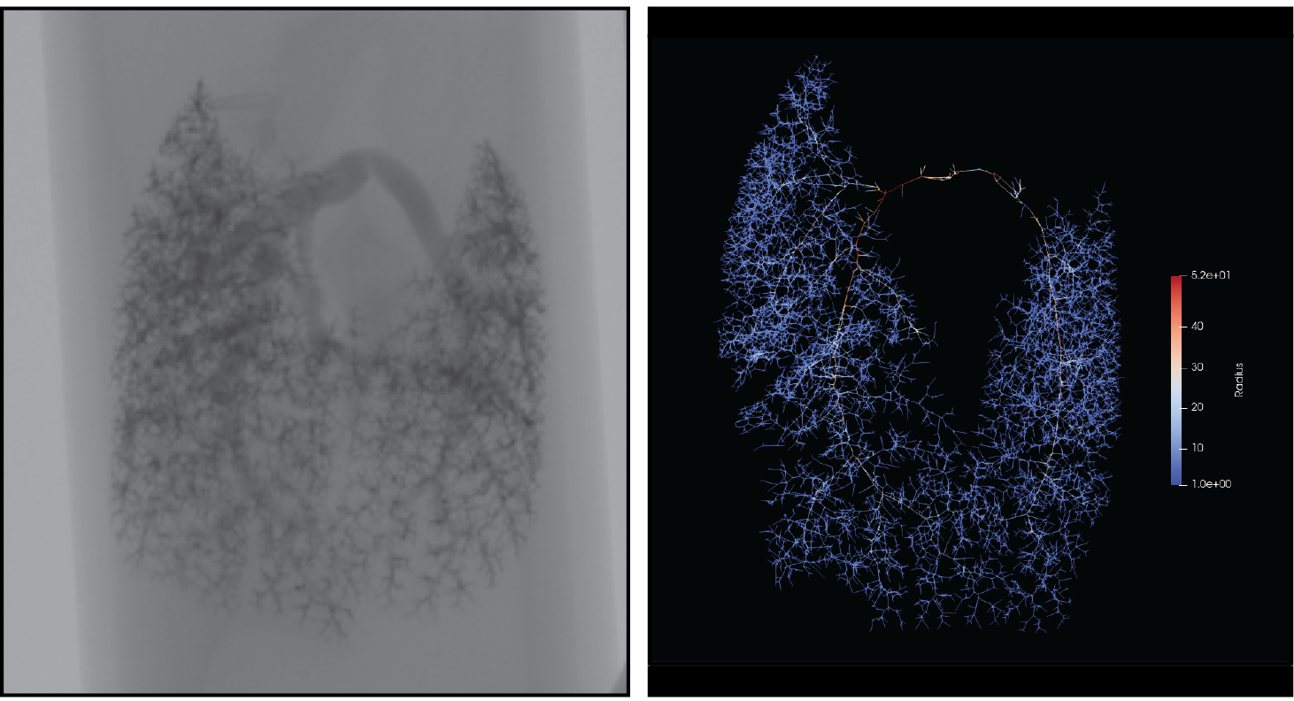 Lung Images