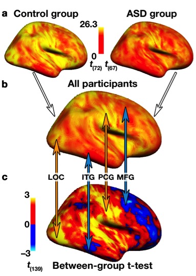 Figure from a paper about Autism Spectrum Disorder