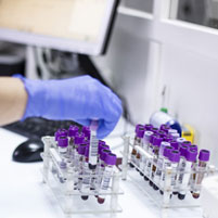 a gloved hand works with test tubes