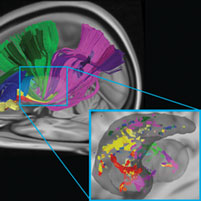 Neuroscientists Identify New Way Several Brain Areas Communicate