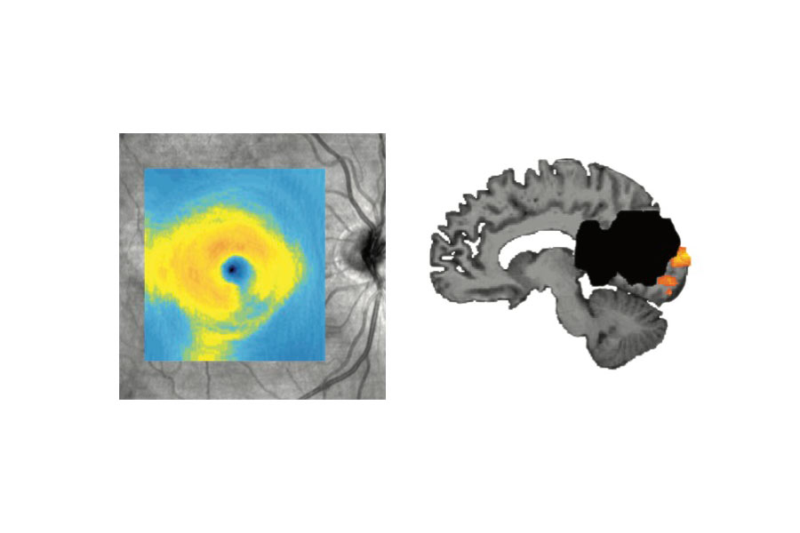 New Study Reshapes Understanding of How the Brain Recovers from Injury