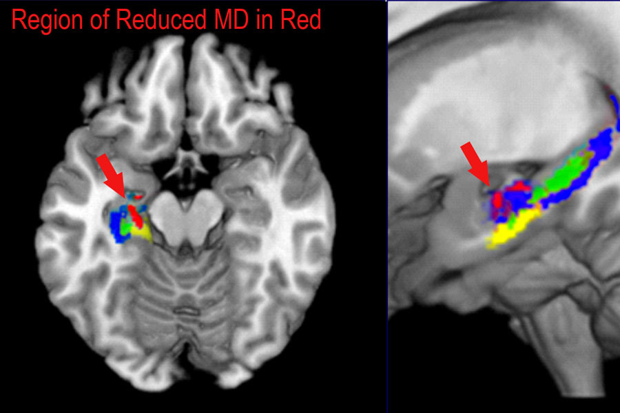 Three Ways Studying Organic Chemistry Changes the Brain