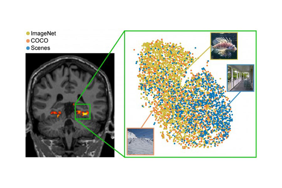 Dataset Bridges Human Vision and Machine Learning