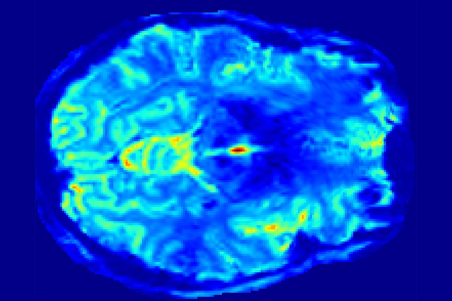 A top down view of the brain obtained during an fMRI scan.