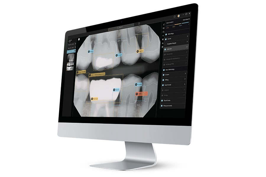 An image of dental xrays displayed on a computer monitor