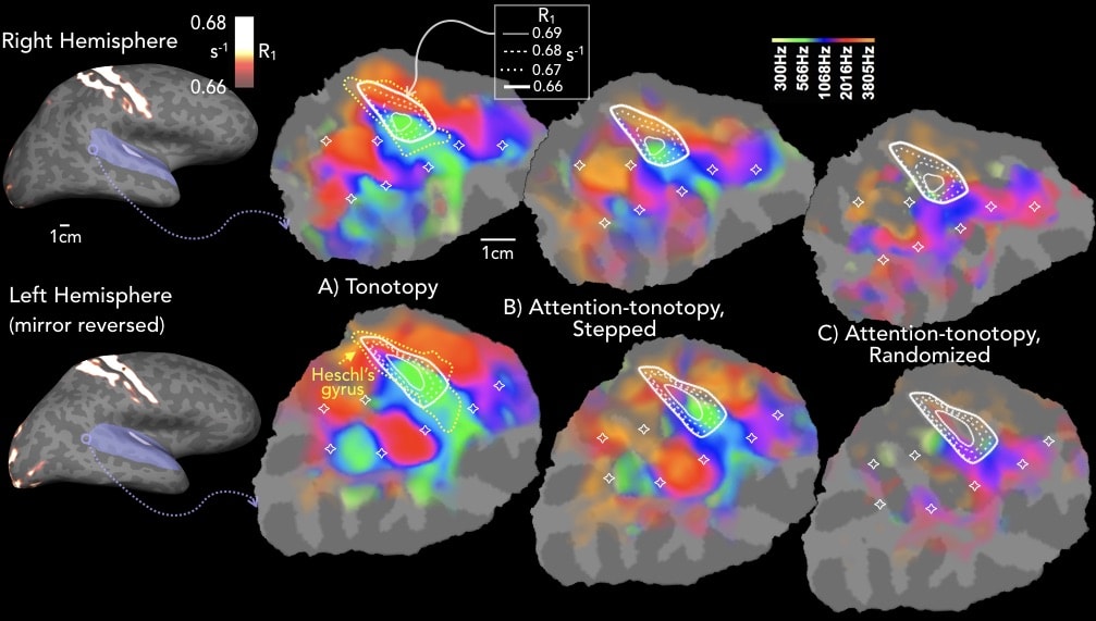 Auditory Attention