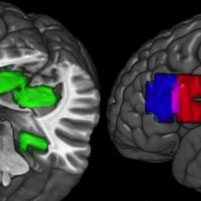 Scientists Gain First Glimpse of New Concepts Developing in the Brain