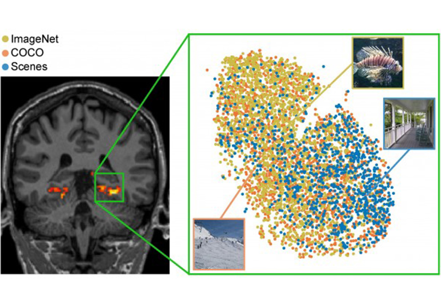 Dataset Bridges Human Vision and Machine Learning