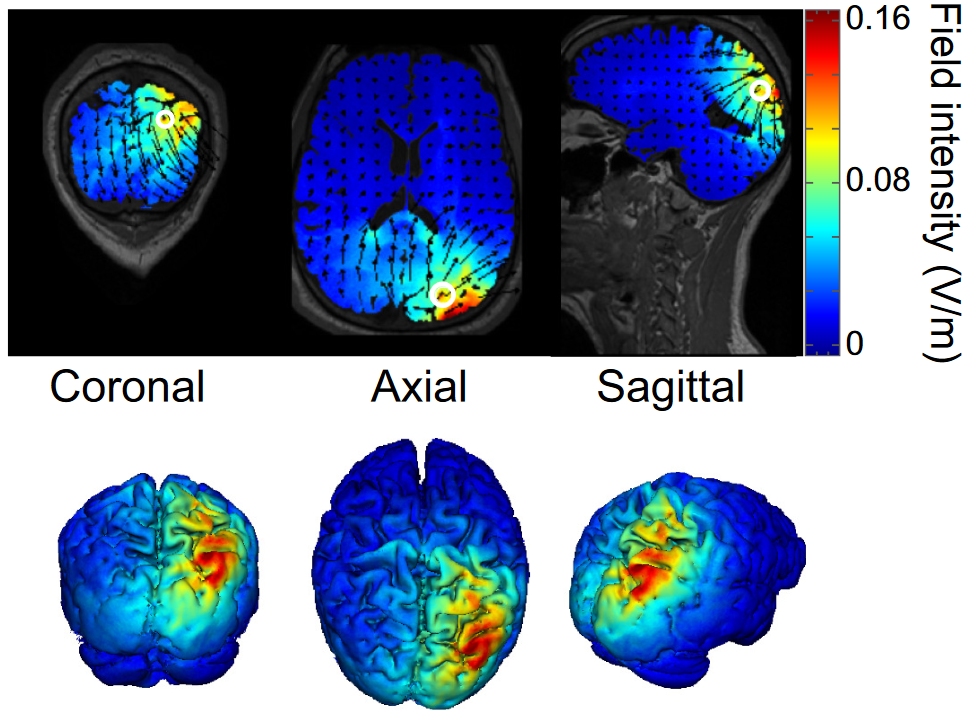 neural-stimulation.png