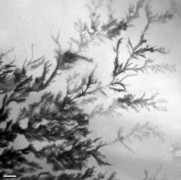 KOMBALAH - TEM image -