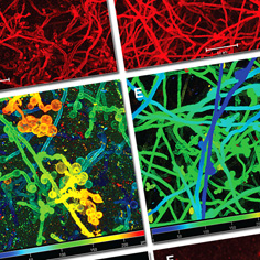 Biofilm Matrix